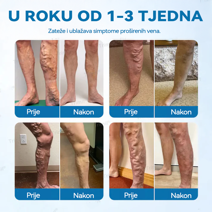 🎖️𝑫𝒊𝒂𝒑𝒂𝒔𝒐𝒏® 𝑽𝒆𝒏𝒂  𝒁𝒂š𝒕𝒊𝒕𝒂 𝑩𝒊𝒍𝒋𝒏𝒊 𝑺𝒑𝒓𝒆𝒋 -👨‍⚕𝑲𝒍𝒊𝒏𝒊č𝒌𝒊 𝒅𝒐𝒌𝒂𝒛𝒂𝒏𝒐 𝒖𝒌𝒍𝒂𝒏𝒋𝒂𝒏𝒋𝒆 𝒑𝒓𝒐š𝒊𝒓𝒆𝒏𝒊𝒉 𝒗𝒆𝒏𝒂 𝒛𝒂 𝒔𝒂𝒎𝒐 7 𝒅𝒂𝒏𝒂!