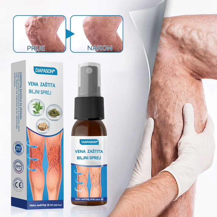🎖️𝑫𝒊𝒂𝒑𝒂𝒔𝒐𝒏® 𝑽𝒆𝒏𝒂  𝒁𝒂š𝒕𝒊𝒕𝒂 𝑩𝒊𝒍𝒋𝒏𝒊 𝑺𝒑𝒓𝒆𝒋 -👨‍⚕𝑲𝒍𝒊𝒏𝒊č𝒌𝒊 𝒅𝒐𝒌𝒂𝒛𝒂𝒏𝒐 𝒖𝒌𝒍𝒂𝒏𝒋𝒂𝒏𝒋𝒆 𝒑𝒓𝒐š𝒊𝒓𝒆𝒏𝒊𝒉 𝒗𝒆𝒏𝒂 𝒛𝒂 𝒔𝒂𝒎𝒐 7 𝒅𝒂𝒏𝒂!
