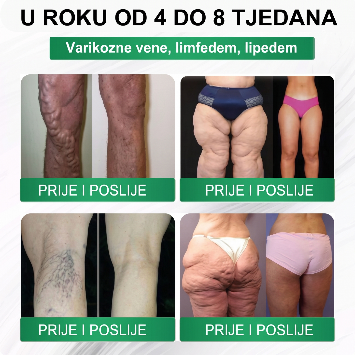 𝑺𝒍𝒖ž𝒃𝒆𝒏𝒂 𝒕𝒓𝒈𝒐𝒗𝒊𝒏𝒂  |🌸🌸𝑳𝒖𝒙𝒂𝒓𝒊𝒔𝒆® 𝑴𝒐𝒓𝒊𝒏𝒈𝒂 𝑿 𝑩𝒆𝒓𝒃𝒆𝒓𝒊𝒏 10-𝑰𝒏-1 𝑵𝒂𝒑𝒓𝒆𝒅𝒂𝒏 𝑵𝒂𝒏𝒐 𝑴𝒊𝒌𝒓𝒐𝒊𝒈𝒍𝒆 𝑭𝒍𝒂𝒔𝒕𝒆𝒓 (𝑱𝒆𝒅𝒏𝒐𝒎 𝒅𝒏𝒆𝒗𝒏𝒐, 𝒗𝒊𝒅𝒍𝒋𝒊𝒗𝒆 𝒑𝒓𝒐𝒎𝒋𝒆𝒏𝒆 𝒖 7 𝒅𝒂𝒏𝒂）✅ 𝑷𝒓𝒆𝒕𝒊𝒍𝒐𝒔𝒕, 𝒅𝒊𝒋𝒂𝒃𝒆𝒕𝒆𝒔, 𝒂𝒑𝒏𝒆𝒋𝒂 𝒖 𝒔𝒏𝒖 𝒊 𝒑𝒓𝒐𝒃𝒍𝒆𝒎𝒊 𝒔𝒂 𝒛𝒈𝒍𝒐𝒃𝒐𝒗𝒊𝒎𝒂